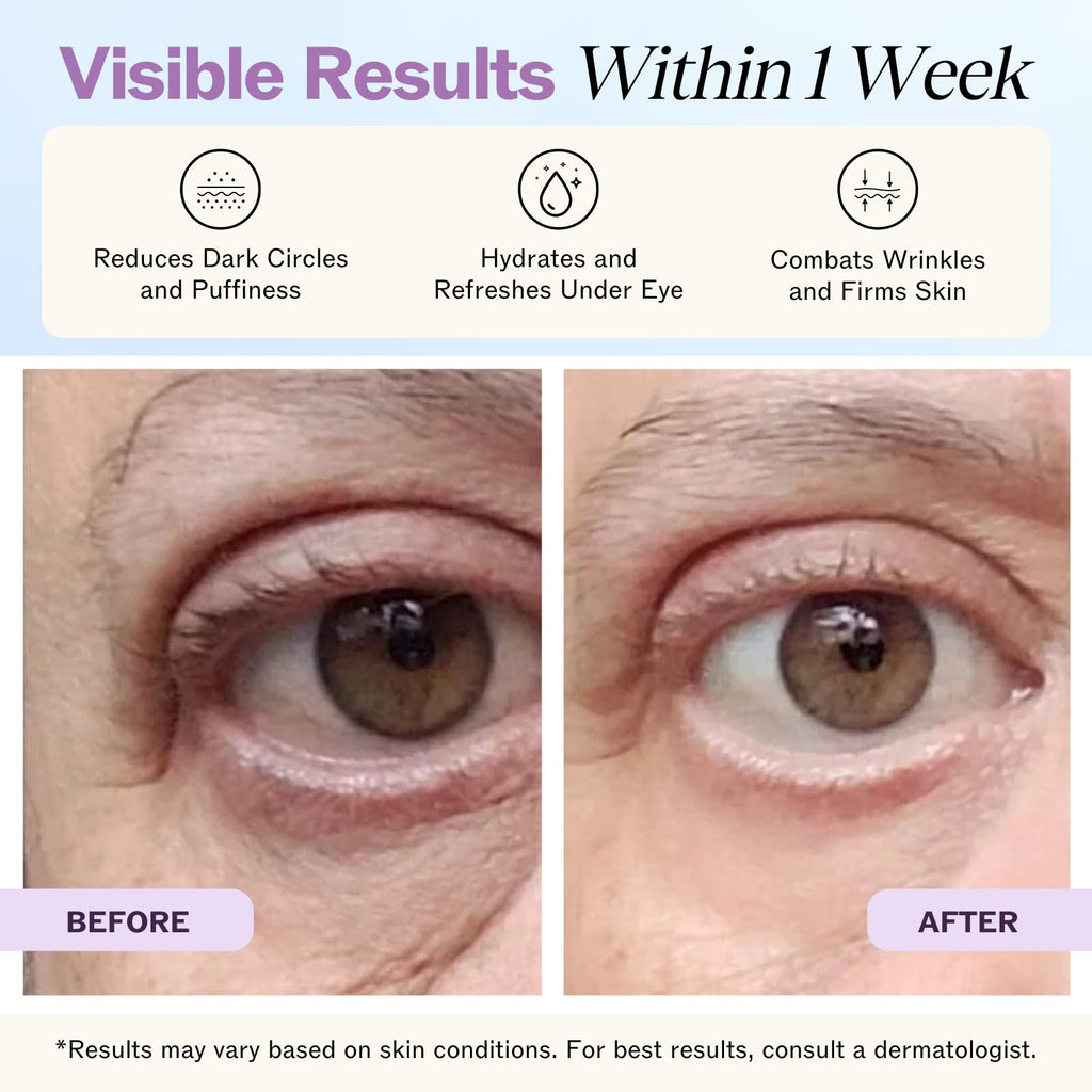 LilyAna Naturals Eye Cream for Dark Circles and Puffiness, Under Eye Cream for Wrinkles and Bags, Anti Aging - helps Improve Dryness; for Sensitive Skin - 1.7 oz - Made in USA