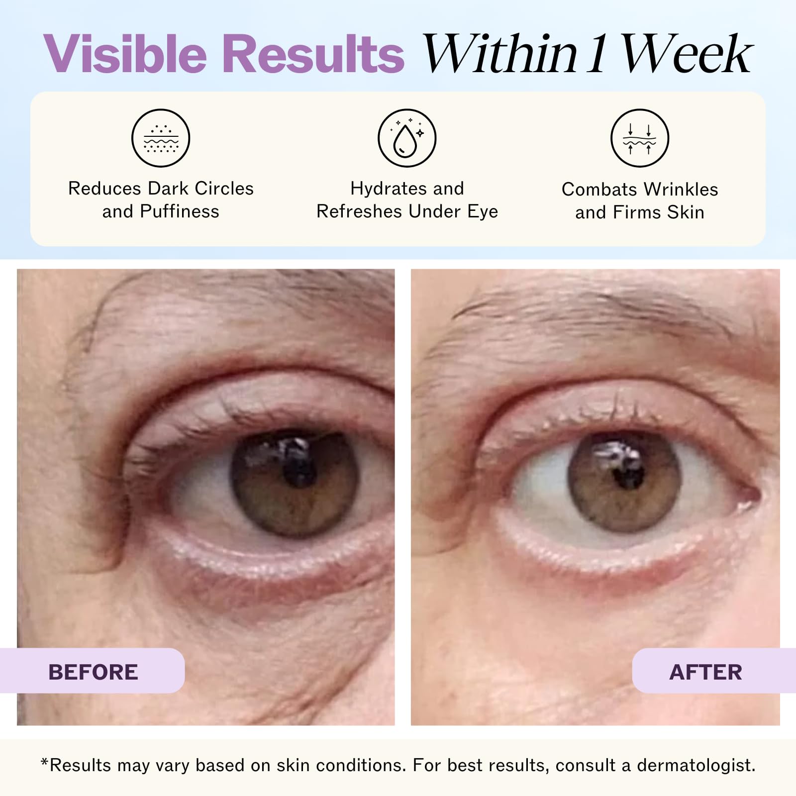 LilyAna Naturals Eye Cream for Dark Circles and Puffiness, Under Eye Cream for Wrinkles and Bags, Anti Aging - helps Improve Dryness; for Sensitive Skin - 1.7 oz - Made in USA