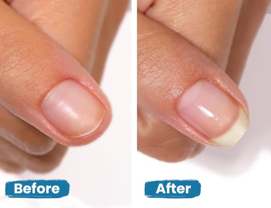 LONDONTOWN Get Strong Nail Hardener - Nail Strengthener Growth Treatment for Damaged Nails, Conditioning Nail Care for Long Healthy Nails, .40fl oz - SkinNails&Makeup