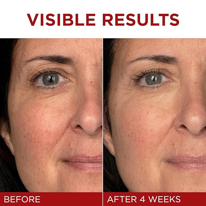 L'Oreal Paris Revitalift Triple Power Anti - Aging Face Moisturizer, Pro Retinol, Hyaluronic Acid & Vitamin C, Reduce Wrinkles 2.55 Oz - My Store