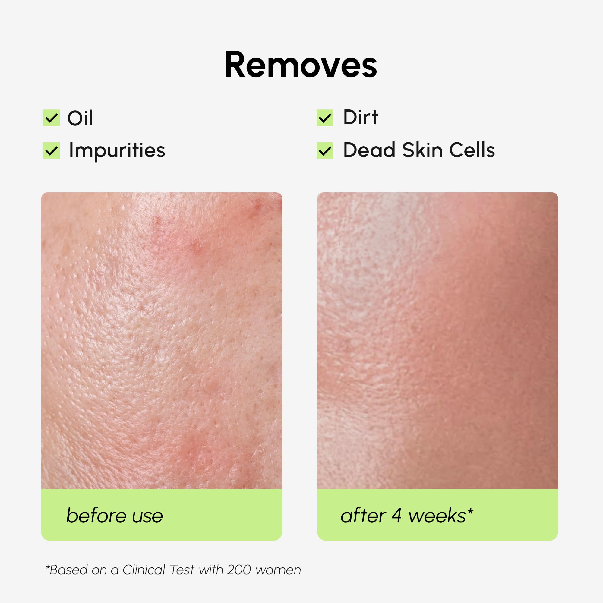 MAREE Exfoliating Toner with Salicylic Acid – AHA BHA Face Exfoliant & Pore Cleaner – BHA Liquid Exfoliant for Sebum & Dead Skin Care Remover – Face Exfoliator – Acido Salicilico Exfoliante Facial - SkinNails&Makeup