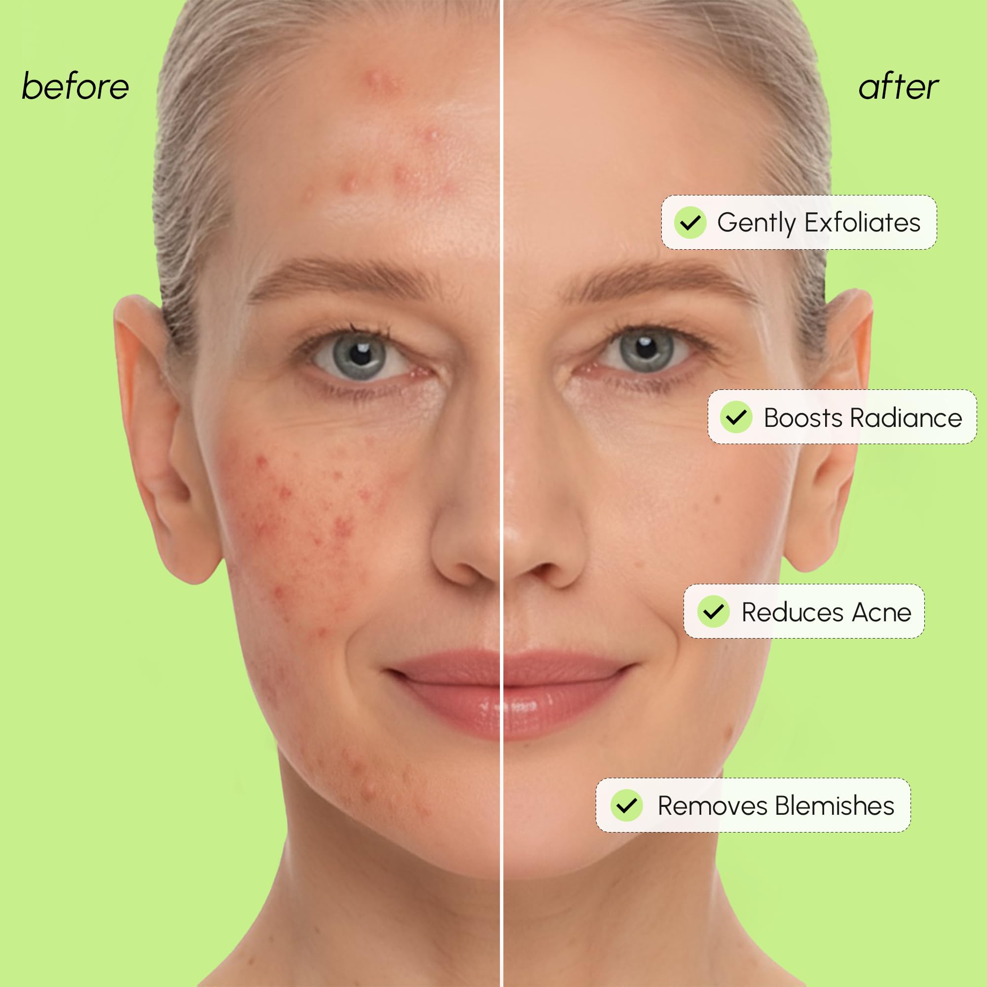 MAREE Exfoliating Toner with Salicylic Acid – AHA BHA Face Exfoliant & Pore Cleaner – BHA Liquid Exfoliant for Sebum & Dead Skin Care Remover – Face Exfoliator – Acido Salicilico Exfoliante Facial - SkinNails&Makeup