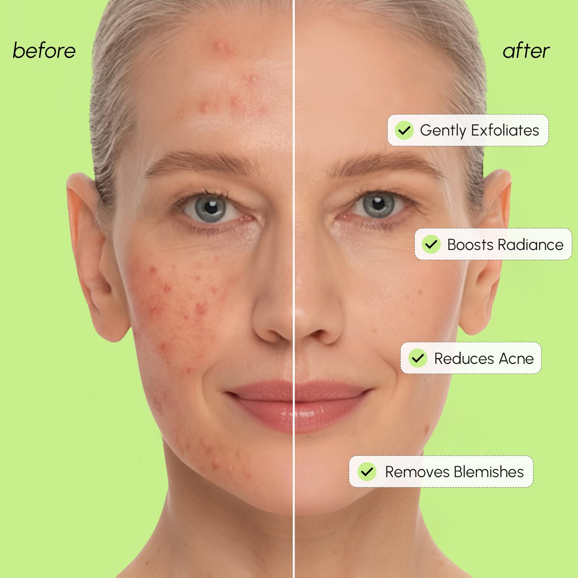 MAREE Exfoliating Toner with Salicylic Acid – AHA BHA Face Exfoliant & Pore Cleaner – BHA Liquid Exfoliant for Sebum & Dead Skin Care Remover – Face Exfoliator – Acido Salicilico Exfoliante Facial - SkinNails&Makeup