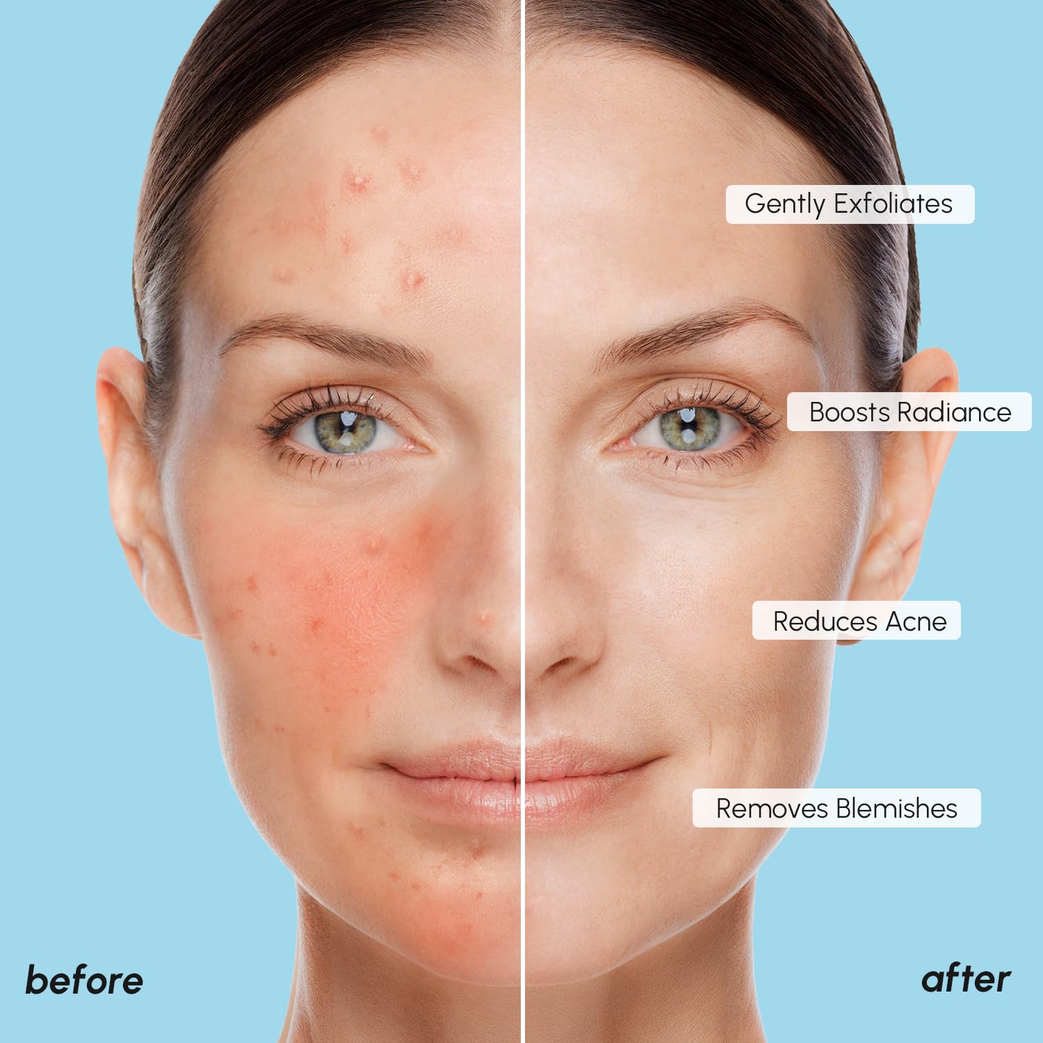 MAREE Glycolic Acid Pads - Toner Pads for Face Cleansing - Exfoliating Pad with Tea Tree Oil, Salicylic Acid & Vitamins E, B3, B5 - Acne Clearing, Skin Pore Resurfacing & Radiance Device - 50 Count - SkinNails&Makeup