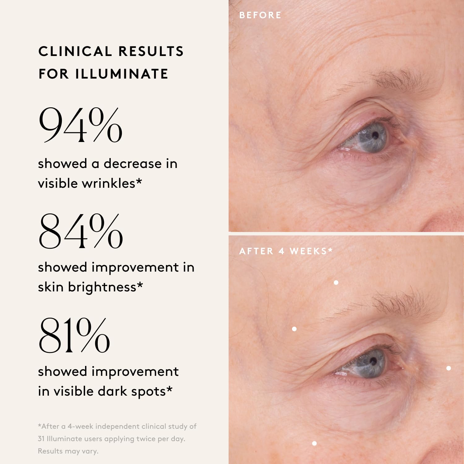 Naked & Thriving Wrinkle - Fighter Set, Includes Renew Resurfacing Night Serum (30 mL) & Illuminate C+ Serum (30 mL), Clinical Results, Dermatologist Loved, Hylauronic Acid & Bakuchiol (Set of 2) - SkinNails&Makeup