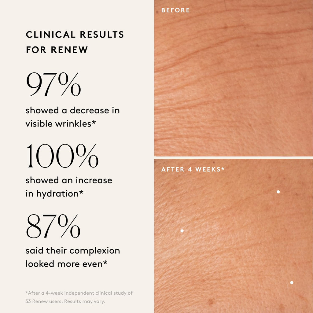 Naked & Thriving Wrinkle - Fighter Set, Includes Renew Resurfacing Night Serum (30 mL) & Illuminate C+ Serum (30 mL), Clinical Results, Dermatologist Loved, Hylauronic Acid & Bakuchiol (Set of 2) - SkinNails&Makeup