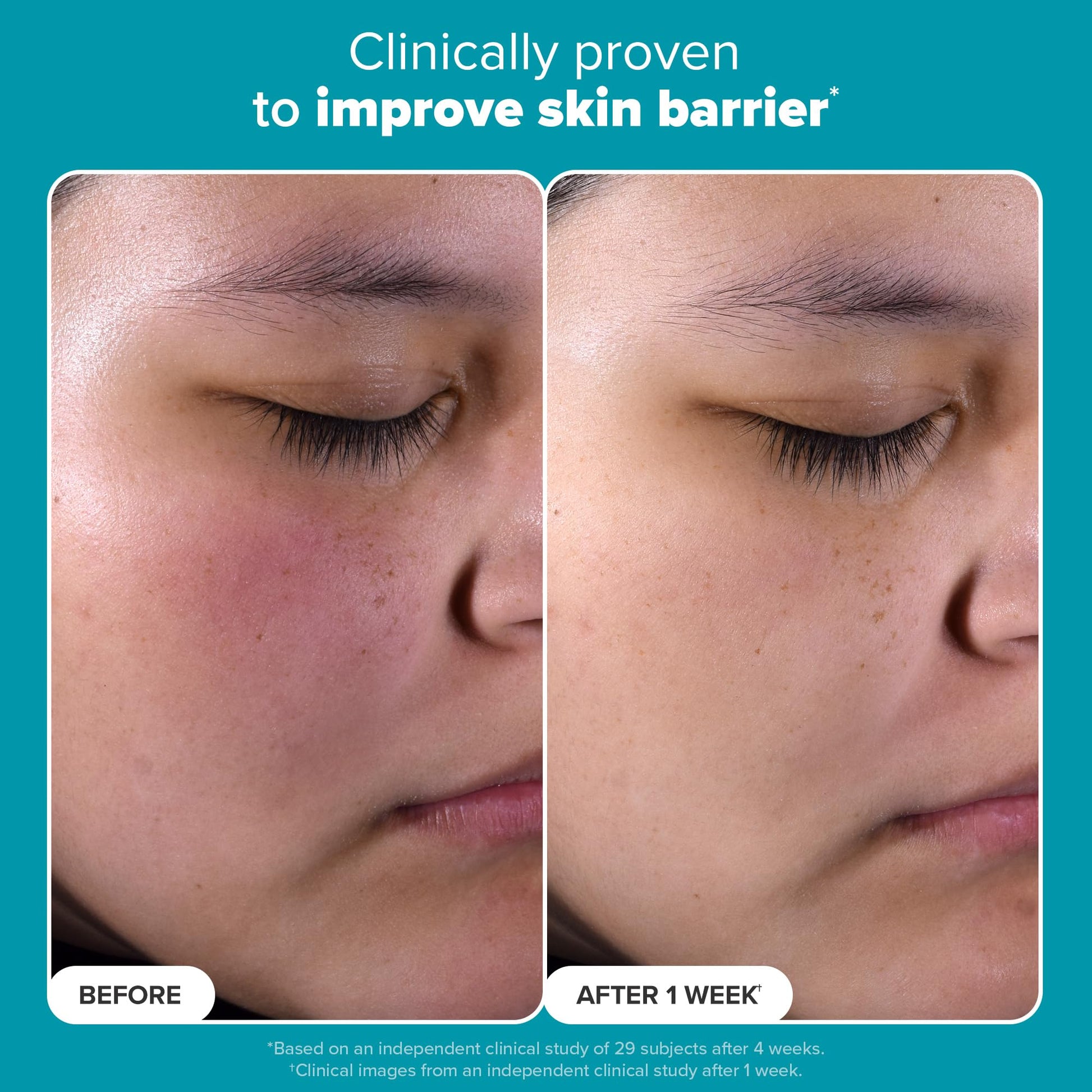 Paulas Choice - SKIN PERFECTING 2% BHA Liquid Salicylic Acid Exfoliant - Facial Exfoliant for Blackheads, Enlarged Pores, Wrinkles & Fine Lines, 4 oz Bottle - SkinNails&Makeup